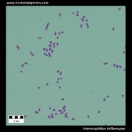 Haemophilus influenzae under microscope